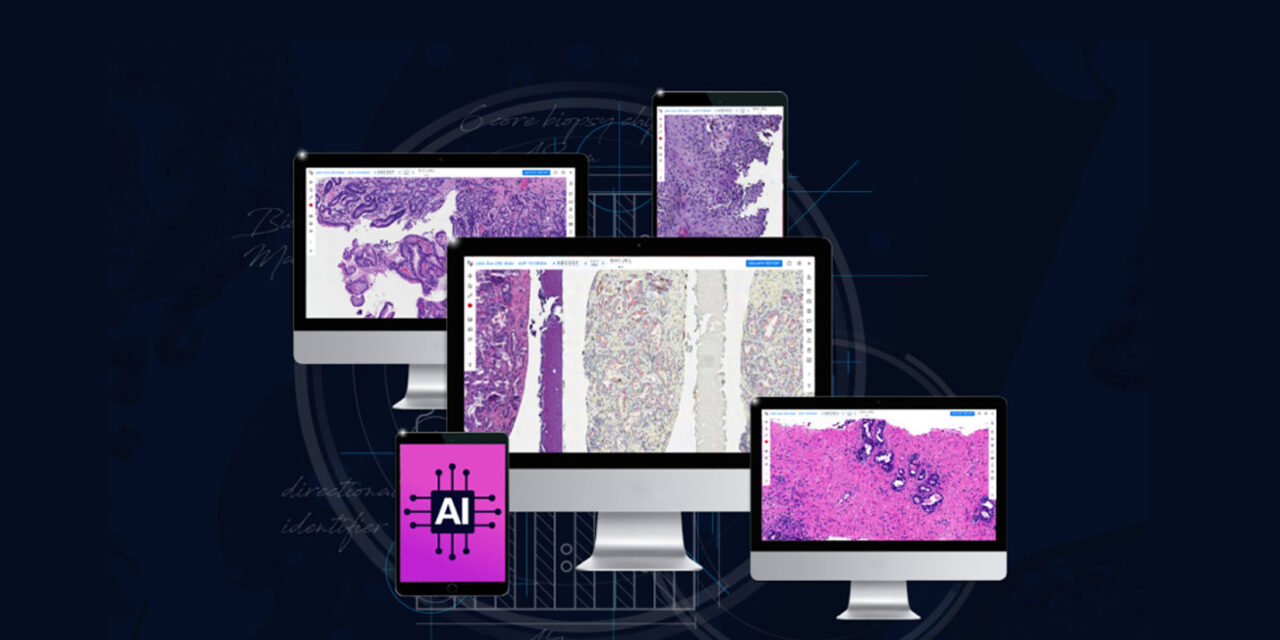 Acupath Adopts Lumea Digital Pathology